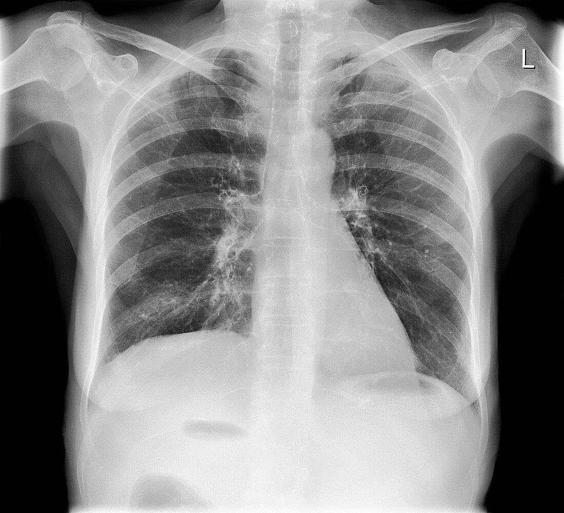 Calcified tissues,X-ray