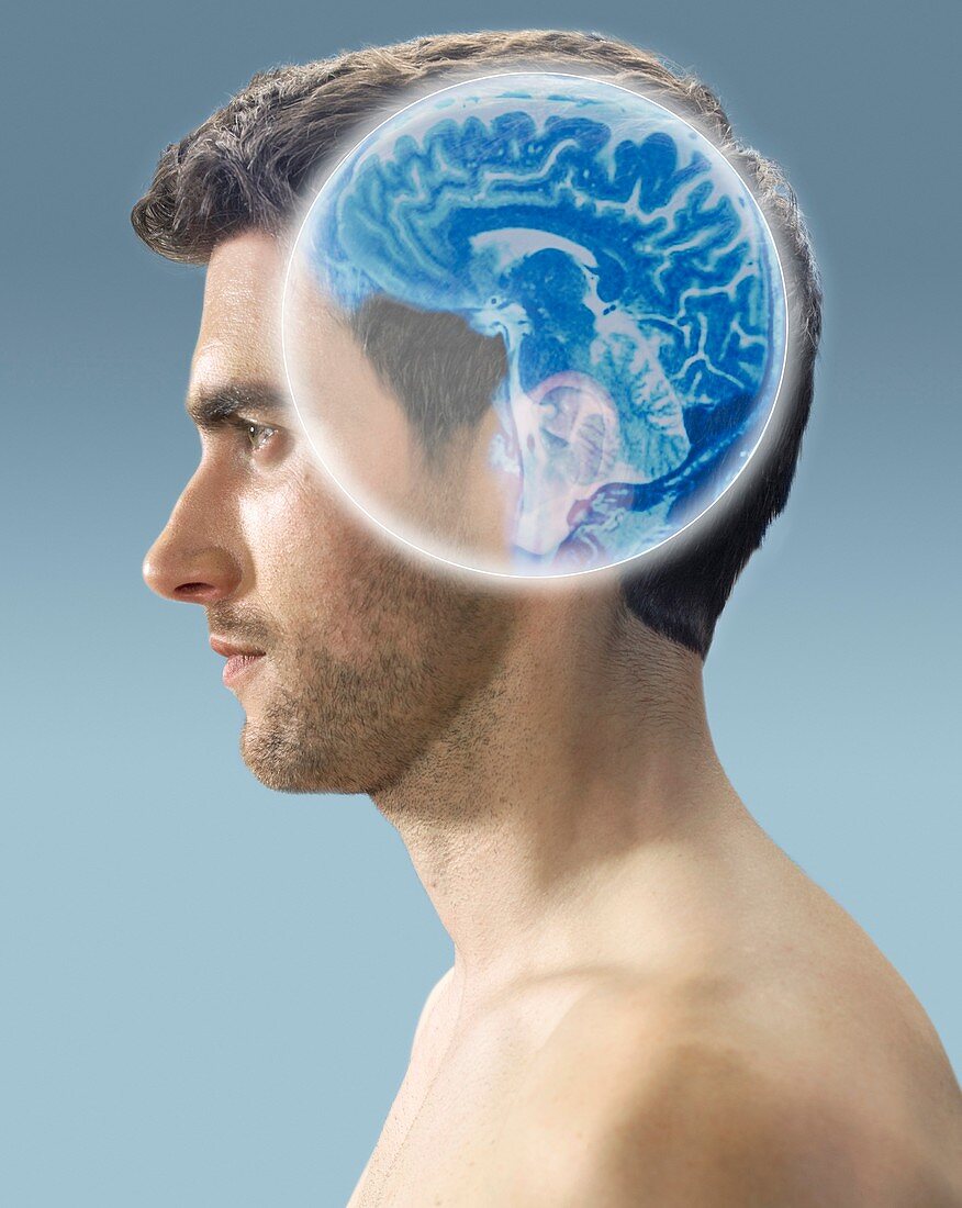 Brain scan,conceptual image