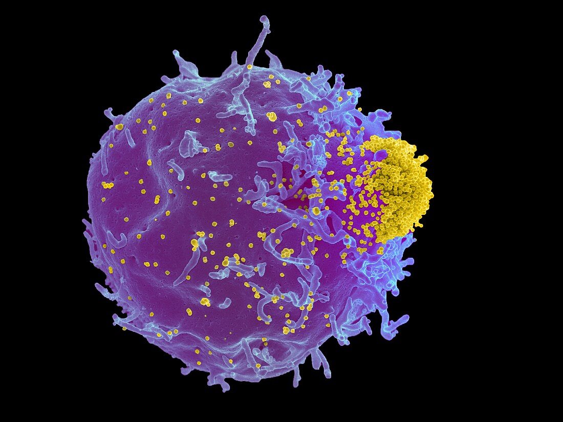 Mouse leukaemia virus and T-cell,SEM