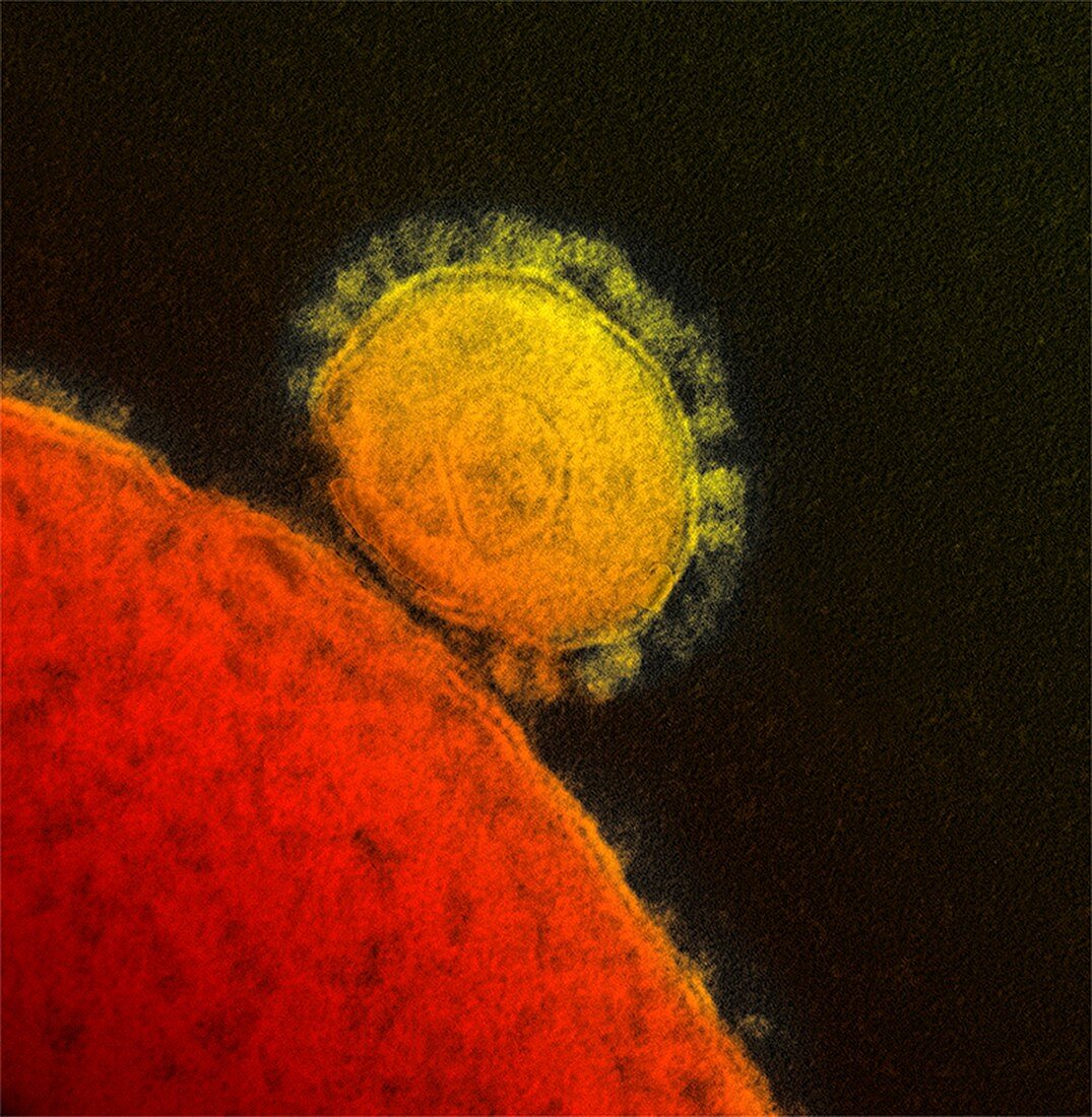 MERS coronavirus,TEM