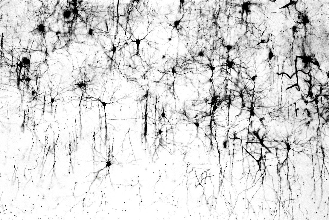 Cerebral cortex nerve cells