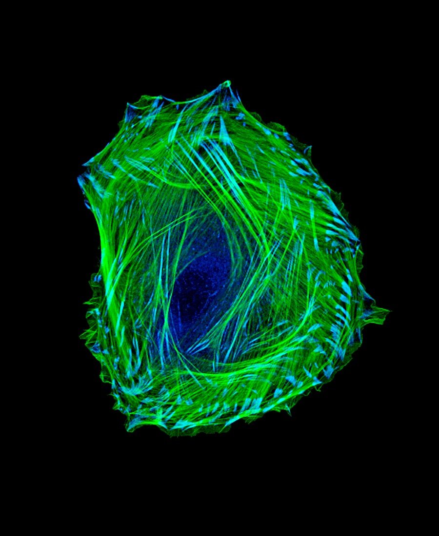 Embryonic smooth muscle cell