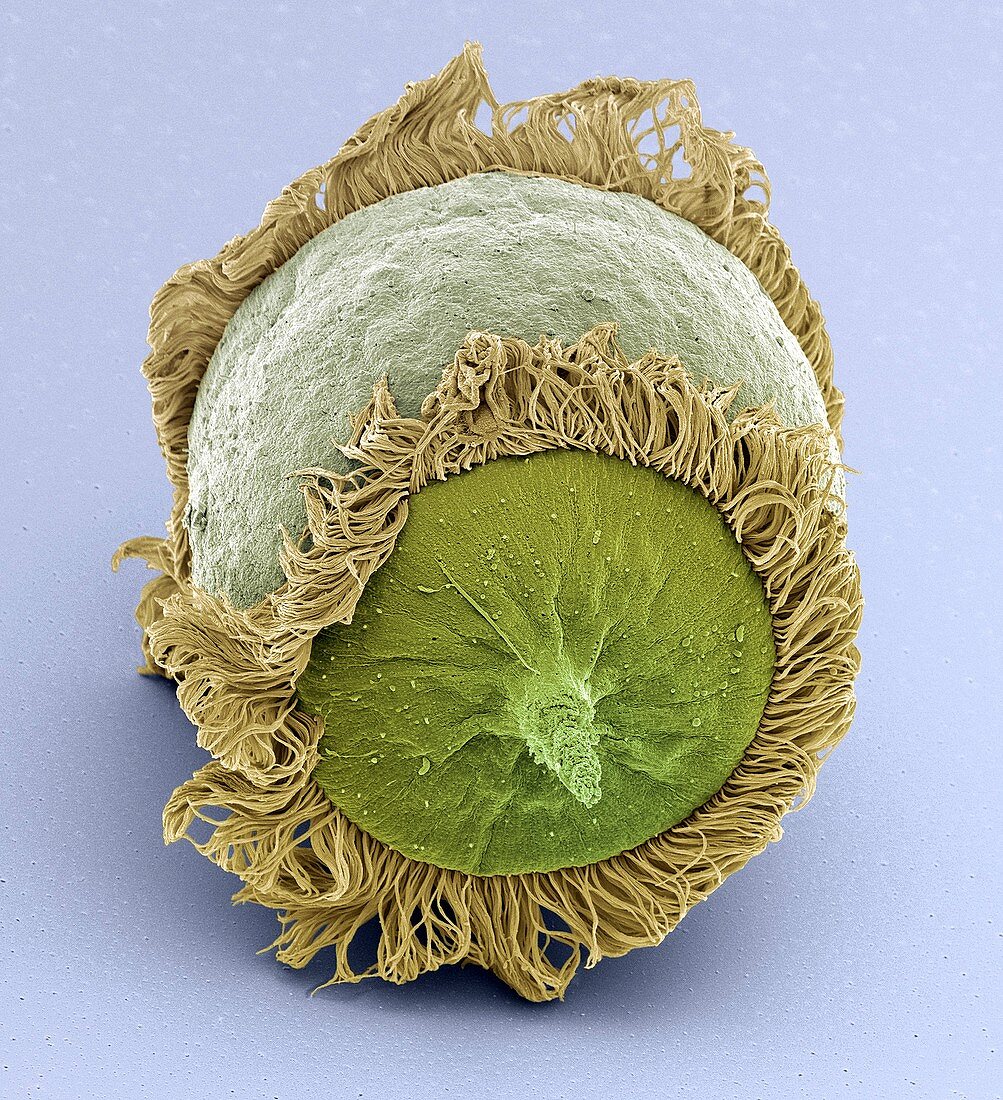 Didinium ciliate protozoan,SEM