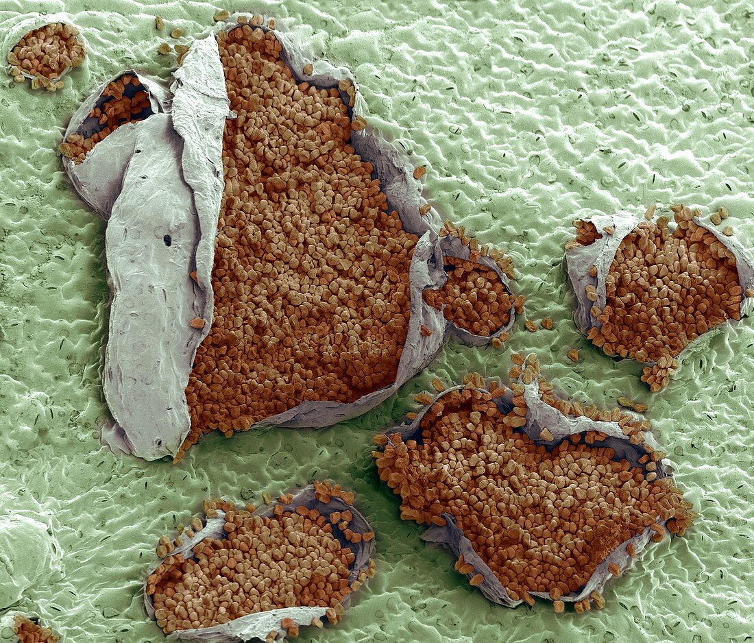 Rust fungus on a bellflower leaf,SEM