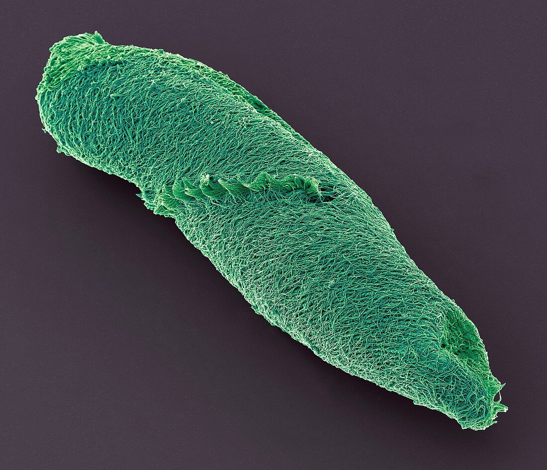 Spirostomum ciliate protozoan,SEM