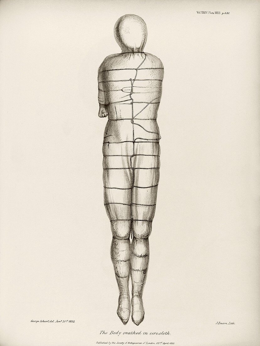 Disinterred 15th-century body,1852