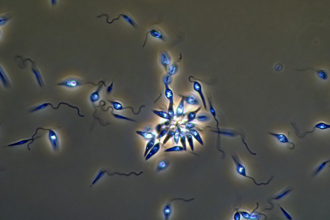 Leishmania parasites,light micrograph