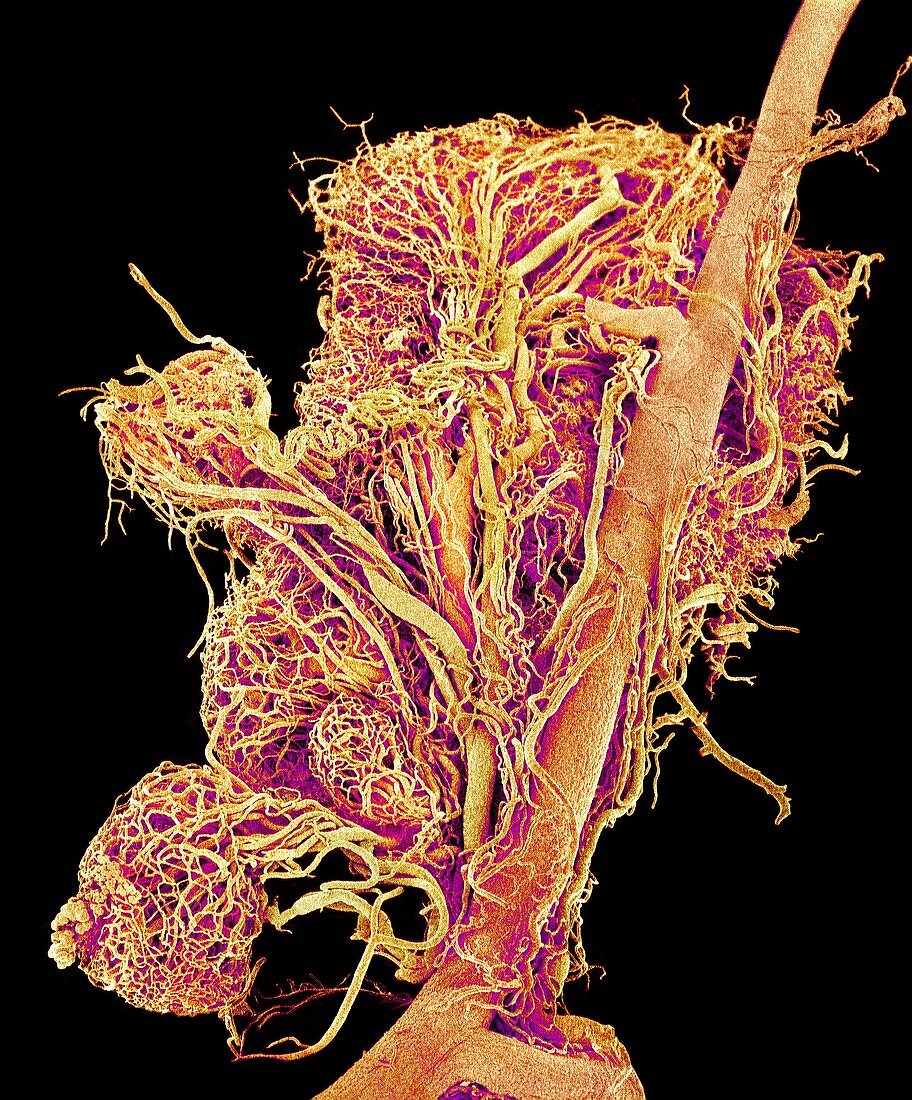 Blood vessels of a lymph node,SEM