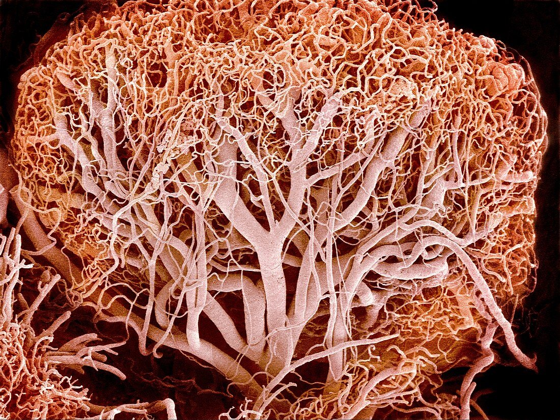Blood vessels of a lymph node,SEM