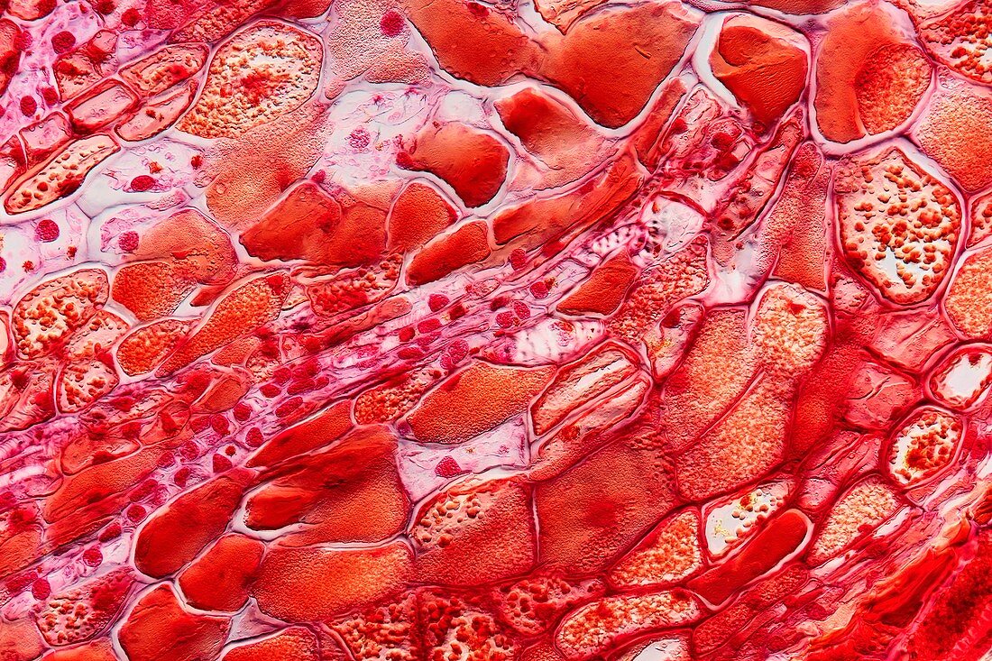 Pine parenchyma cells,light micrograph