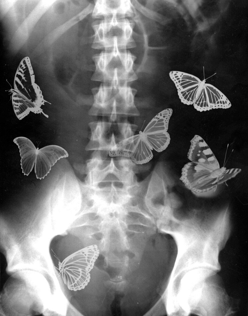 Butterflies in the stomach