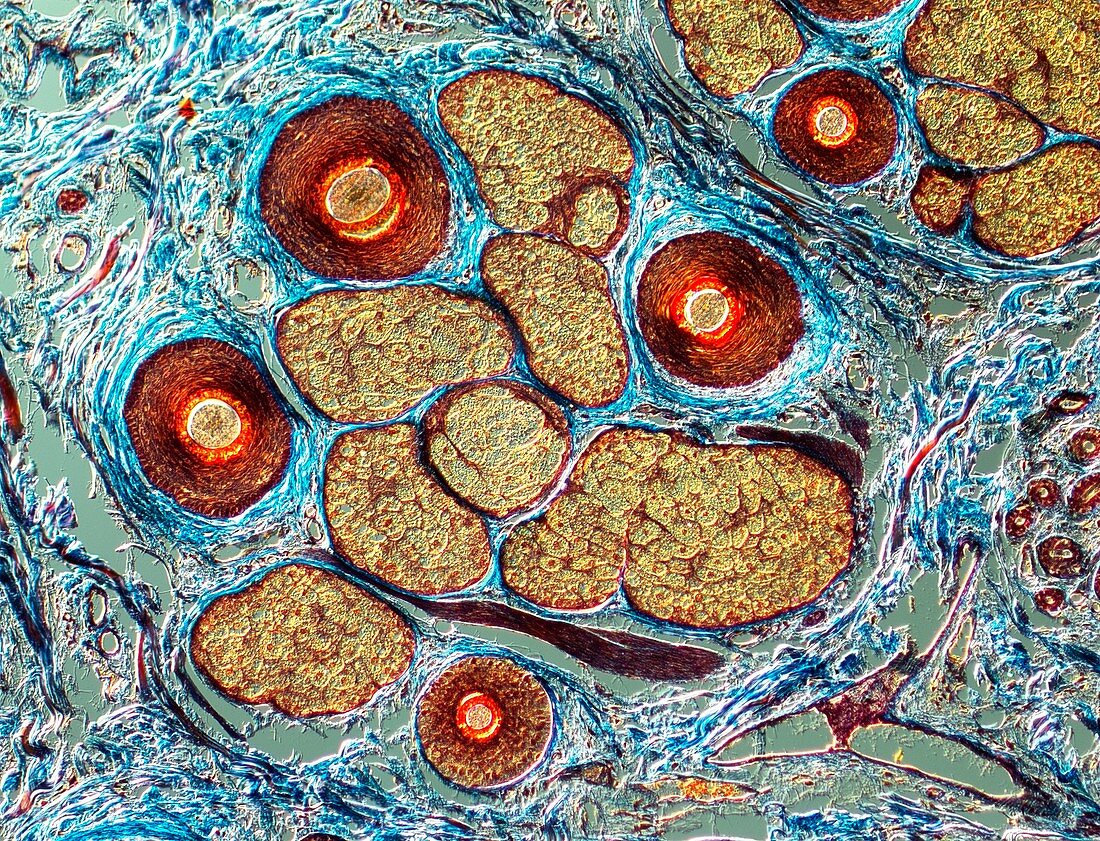 Cross-section through human hairs,LM