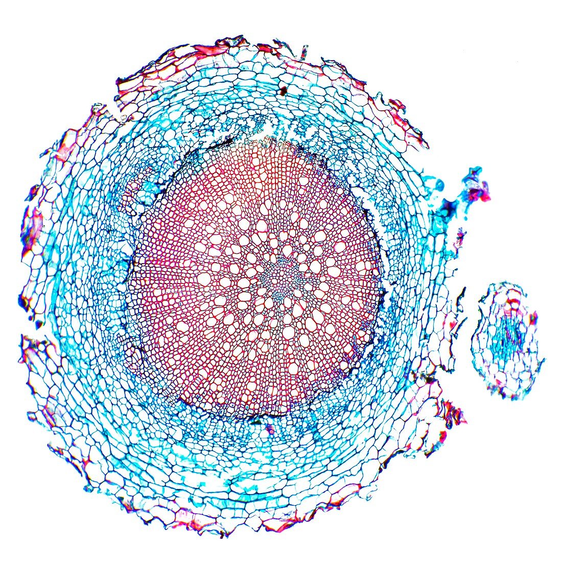 Foxglove root,light micrograph