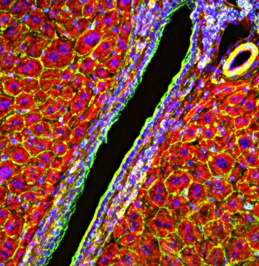Liver triad,fluorescence micrograph