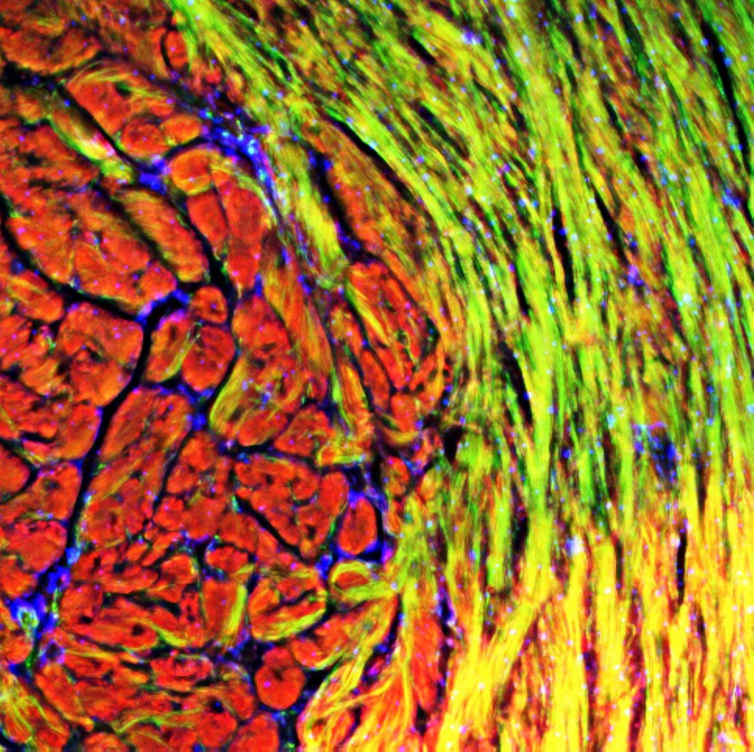 Cardiac muscle,fluorescence micrograph