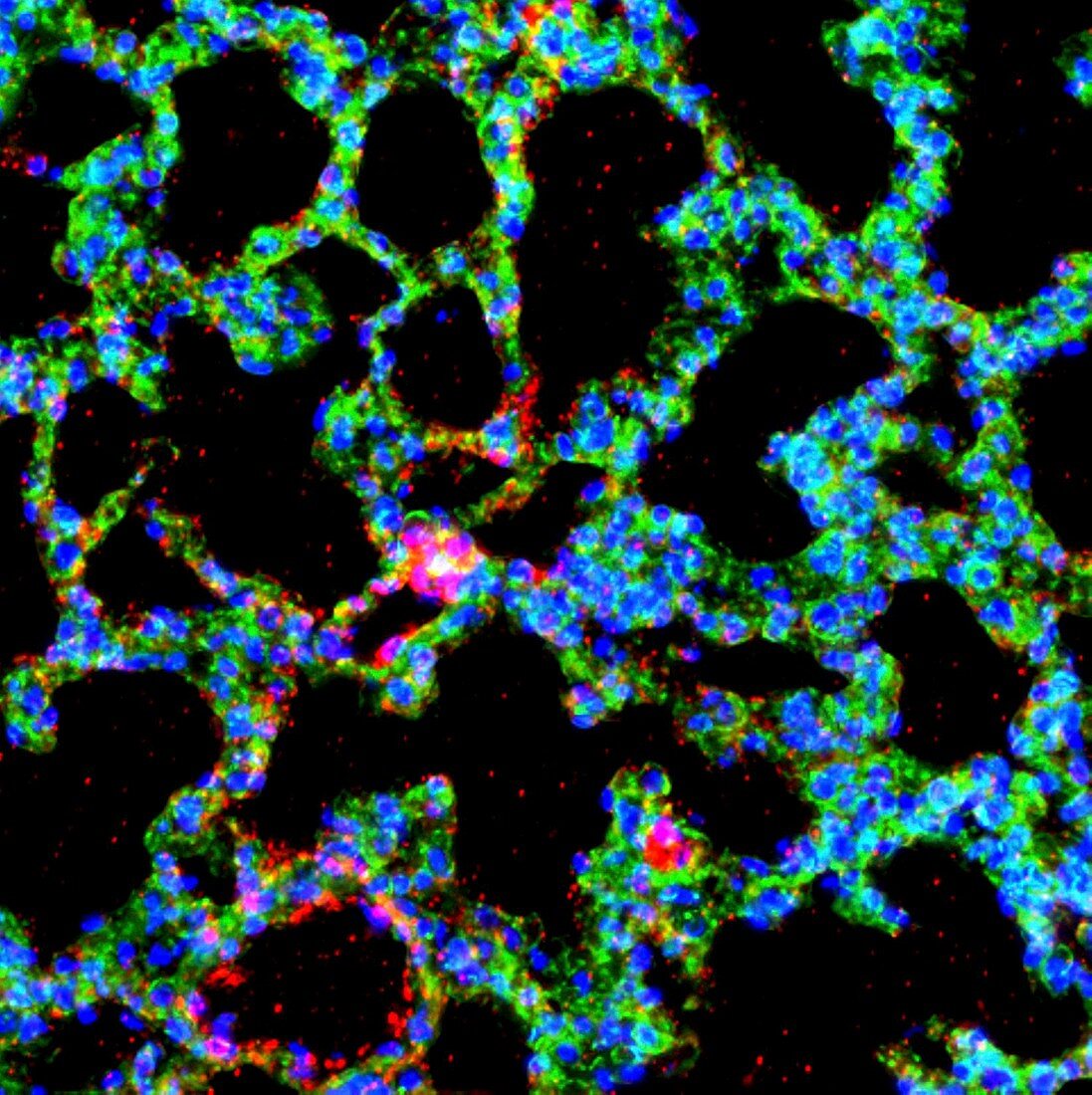 Lung alveoli,fluorescence micrograph
