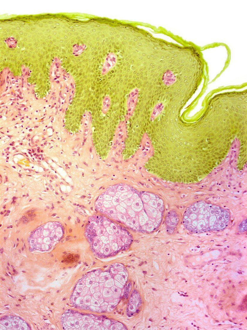 Labial skin,light micrograph