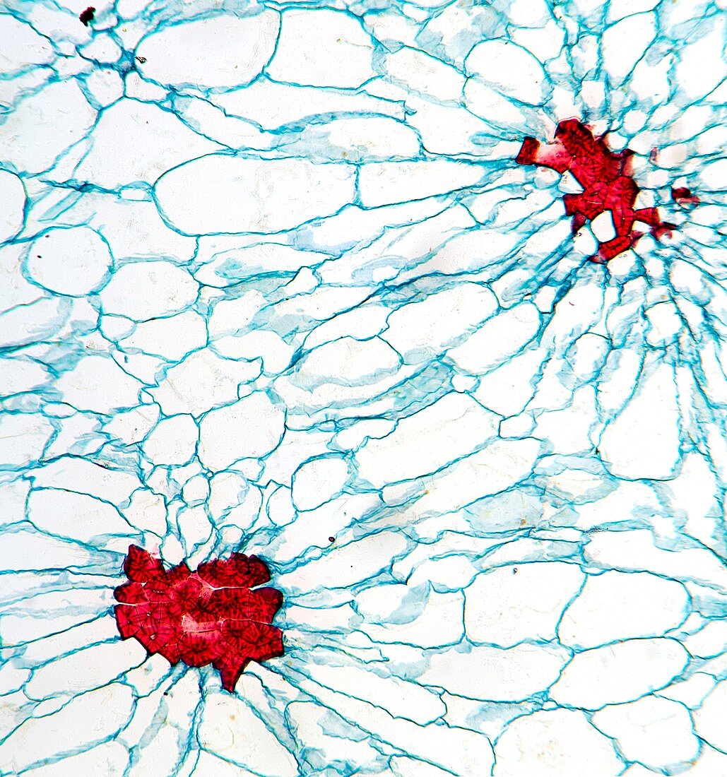 Pear fruit stone cells,light micrograph