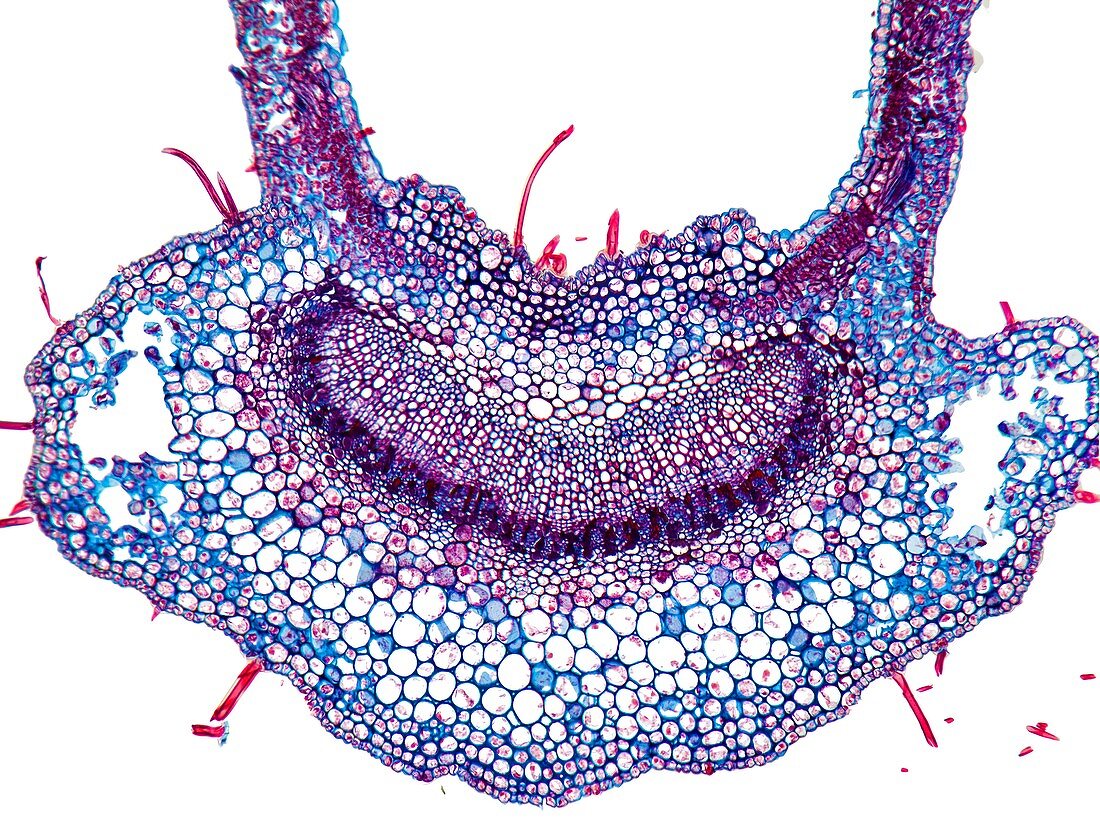 Medlar leaf,light micrograph