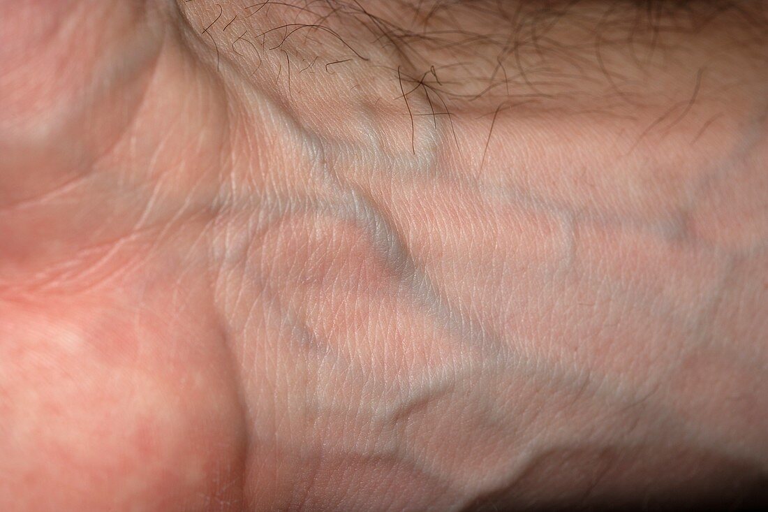 Veins and on man's wrist,close-up