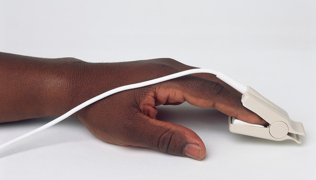 Hand wearing pulse oximeter