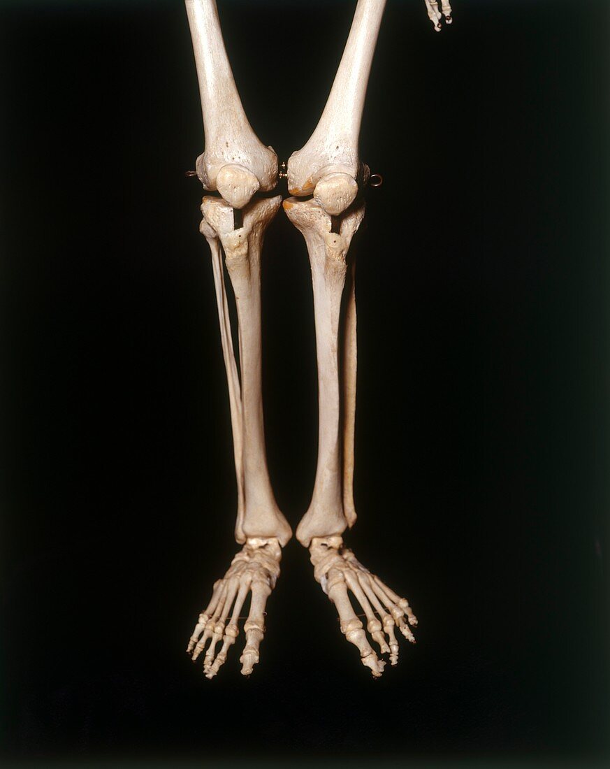 Human skeleton,legs and feet,front view