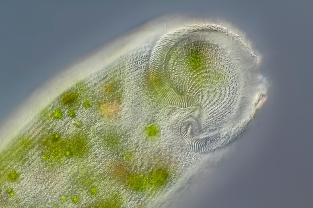 Stentor ciliate,LM