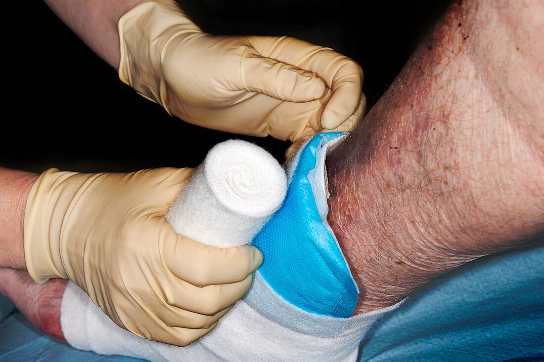 Dressing a laceration