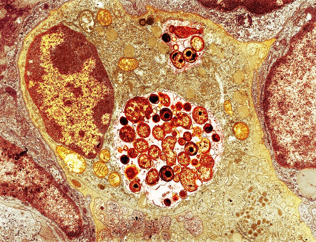 Chlamydia bacteria in a lung cell,TEM