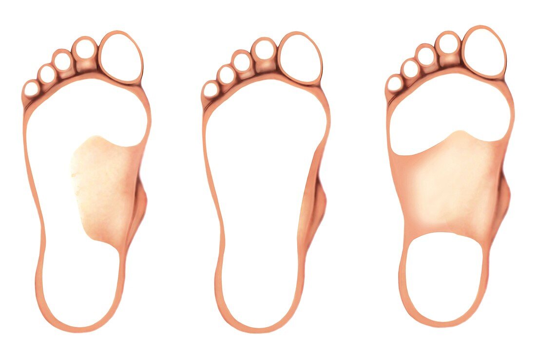 Anatomy regions of the foot,footprints