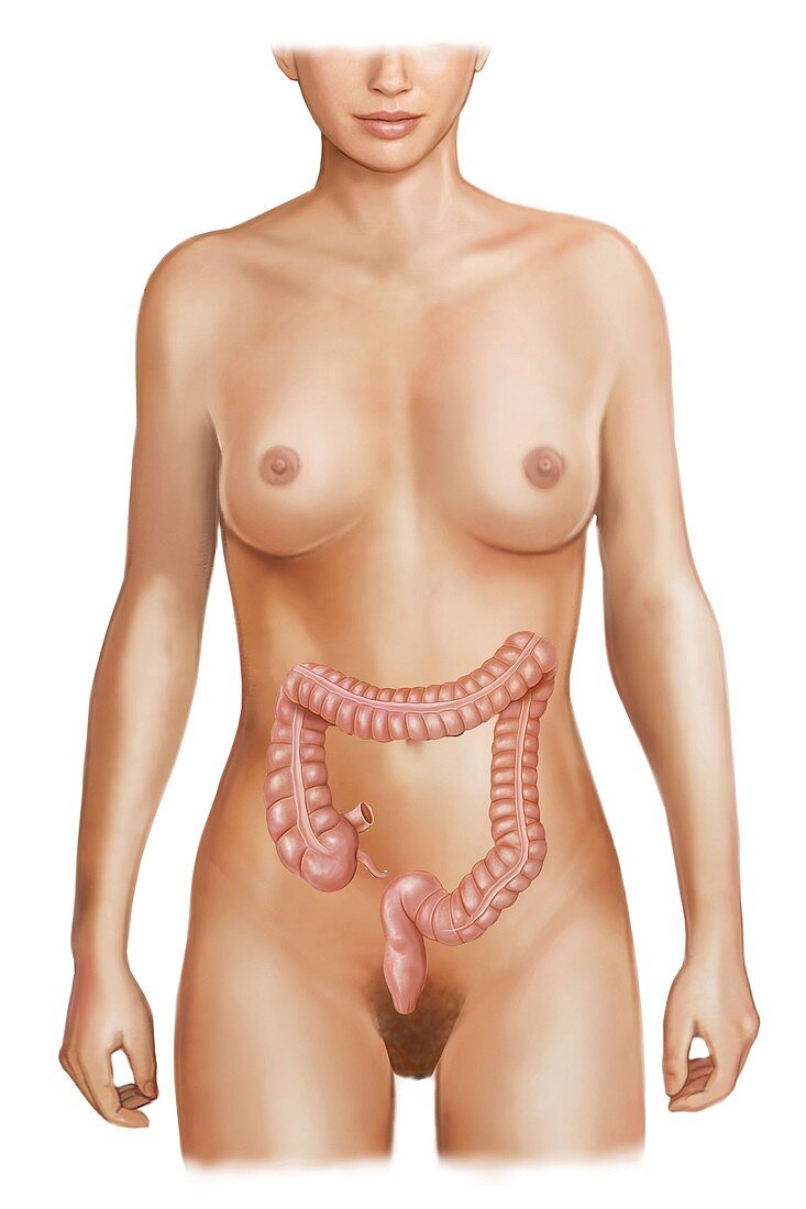 External projection of the colon