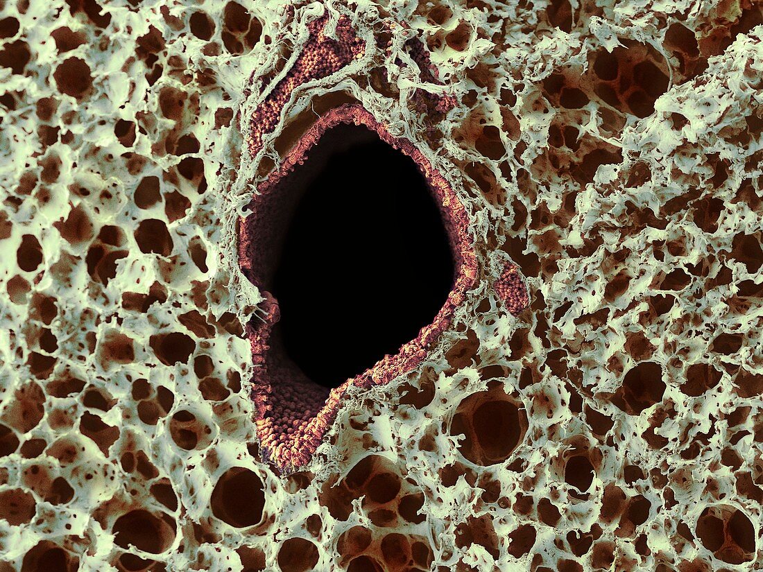 Lung tissue,SEM