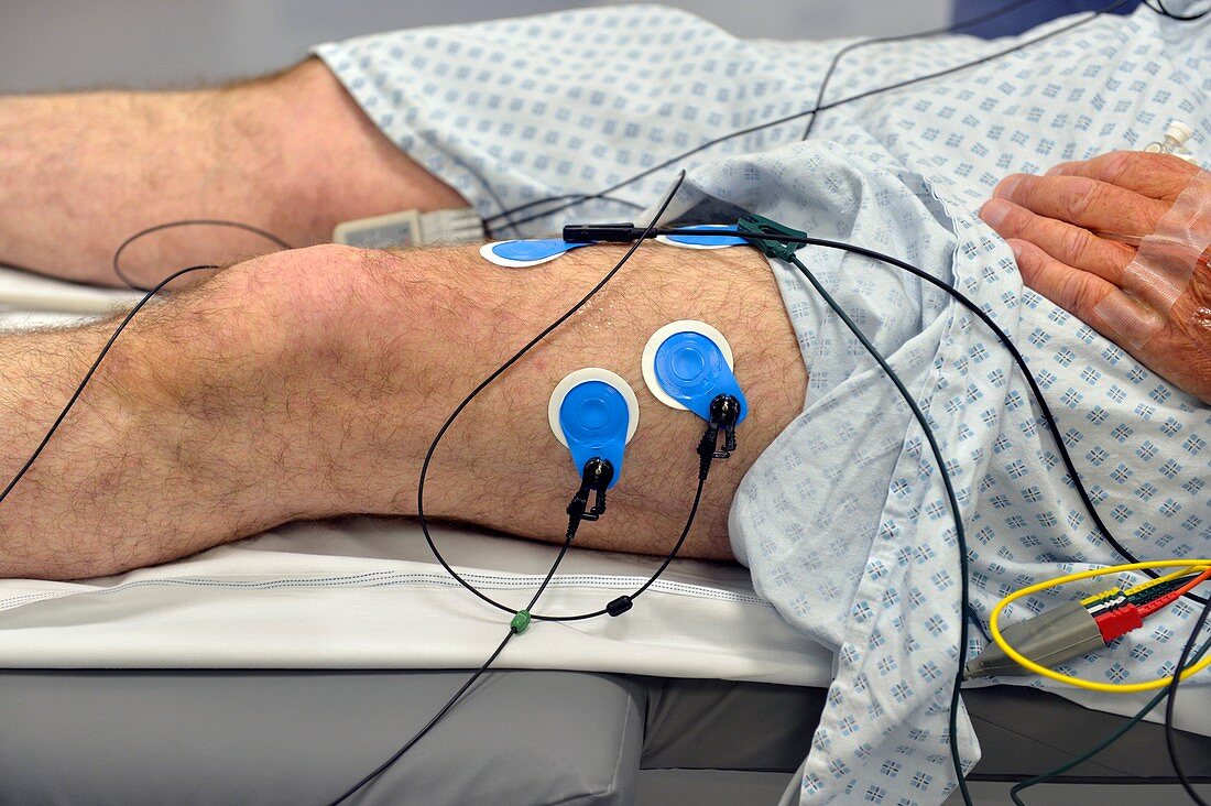 Electrocardiogram electrodes on leg