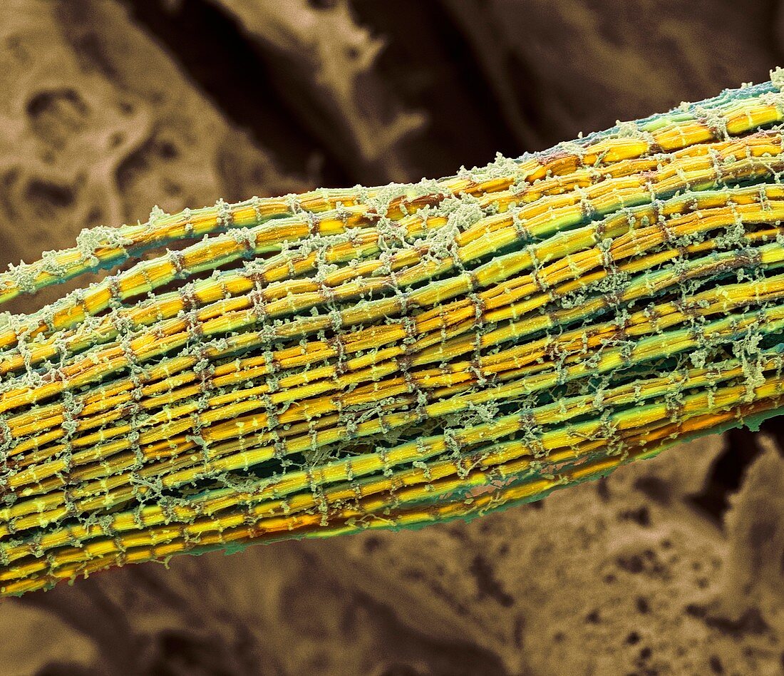 Skeletal muscle fibres,SEM
