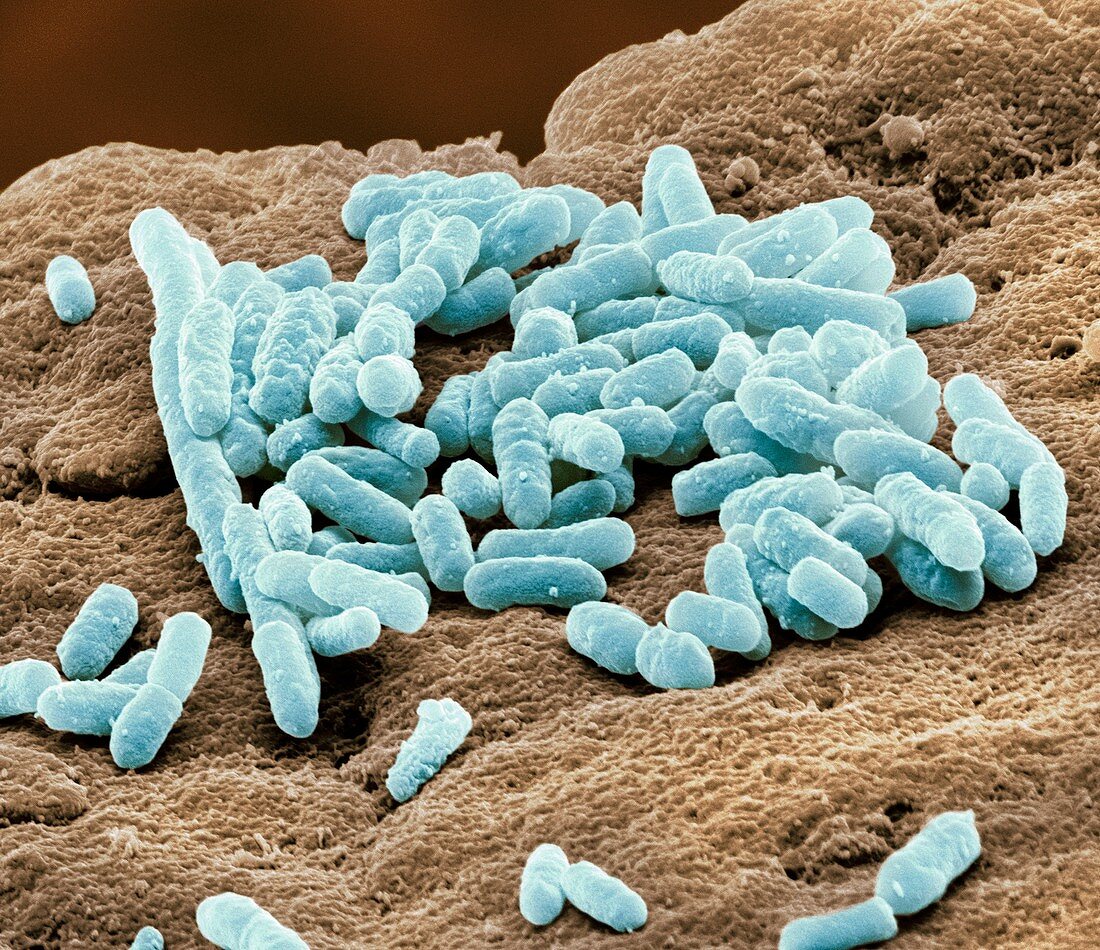Lactobacillus bacteria,SEM
