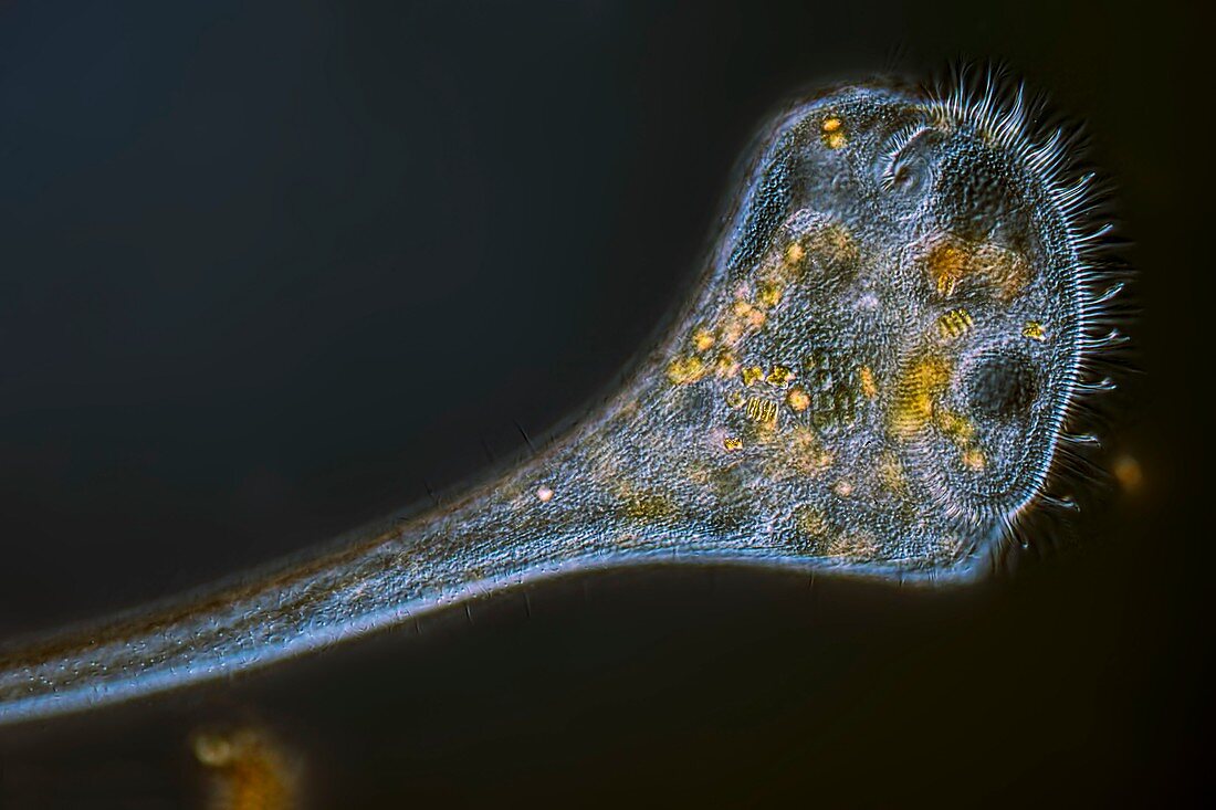 Stentor protozoan,light micrograph