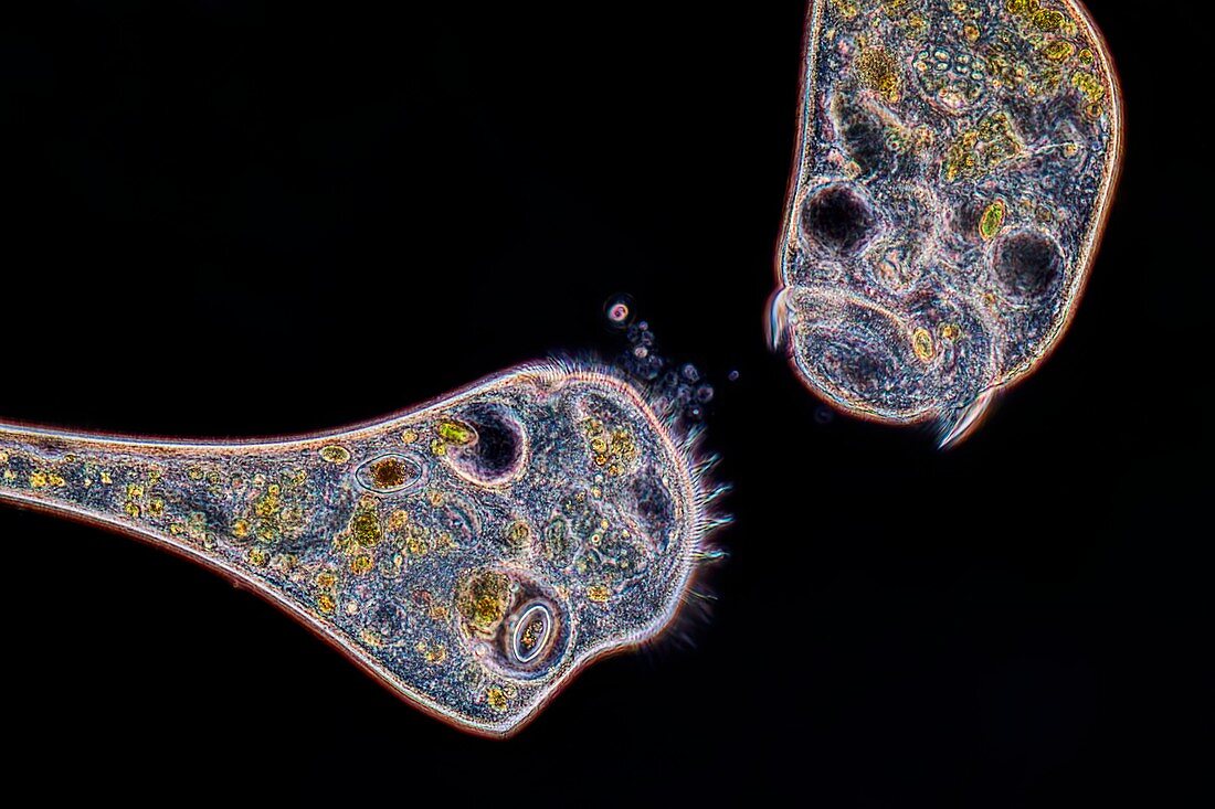 Stentor protozoan,light micrograph