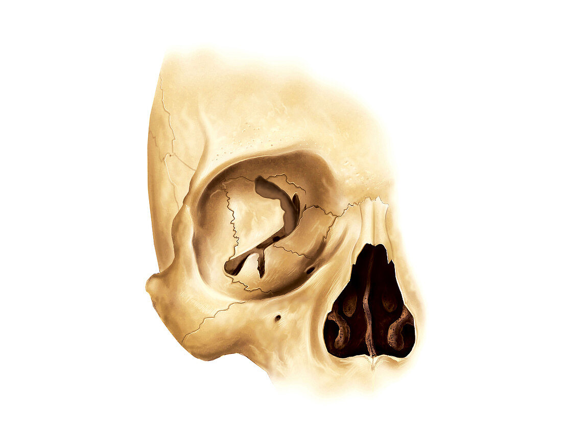 Orbital cavity,artwork