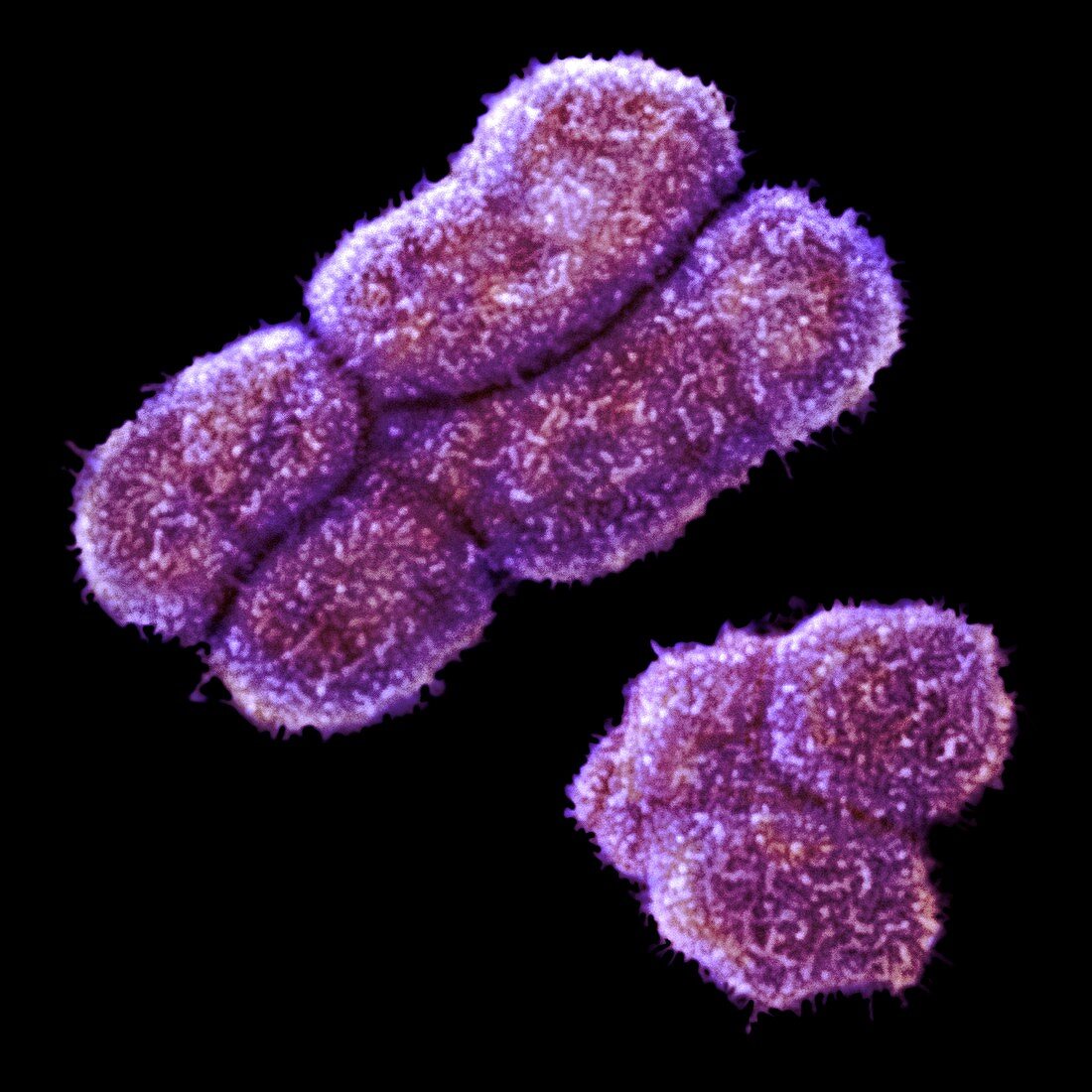 Male human sex chromosomes,SEM
