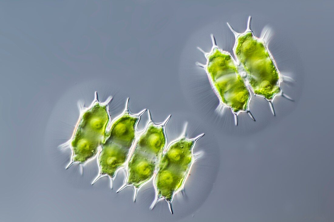 Xanthidium antilopaeum green alga,LM
