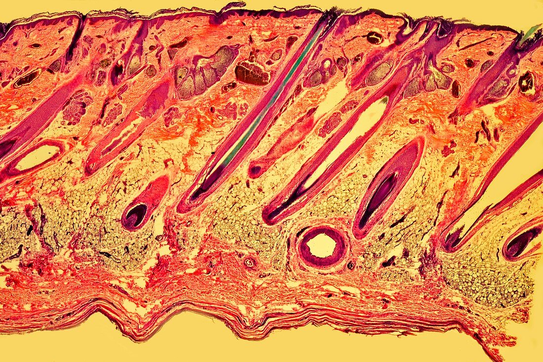 Skin,light micrograph