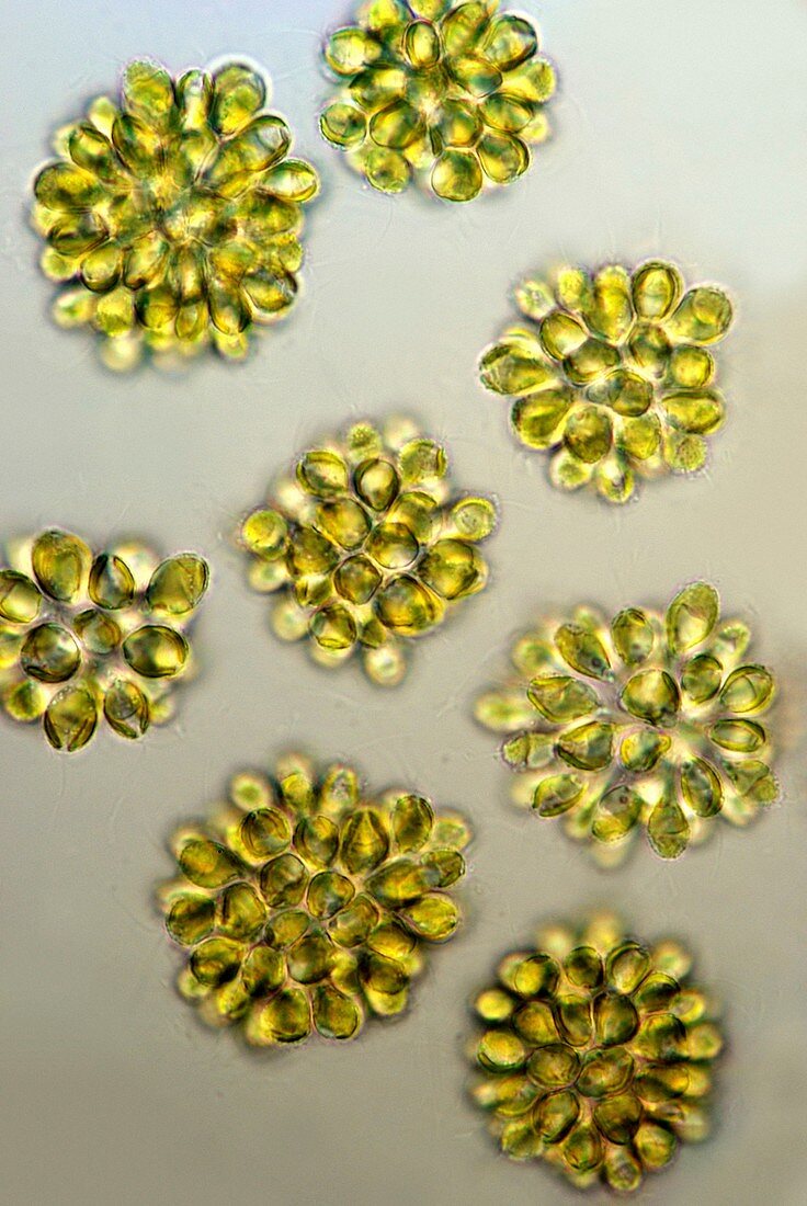 Synura golden algae,light micrograph