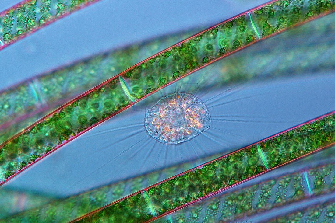 Heliozoan and alga,light micrograph