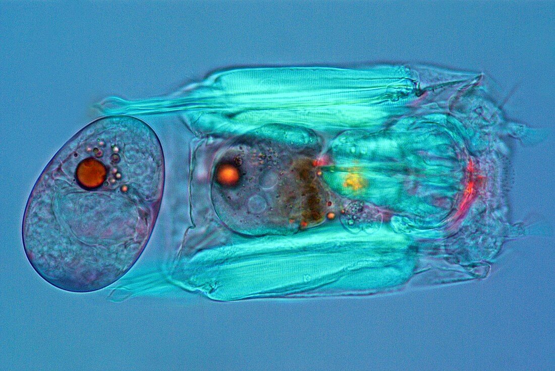 Polyarthra rotifer,light micrograph