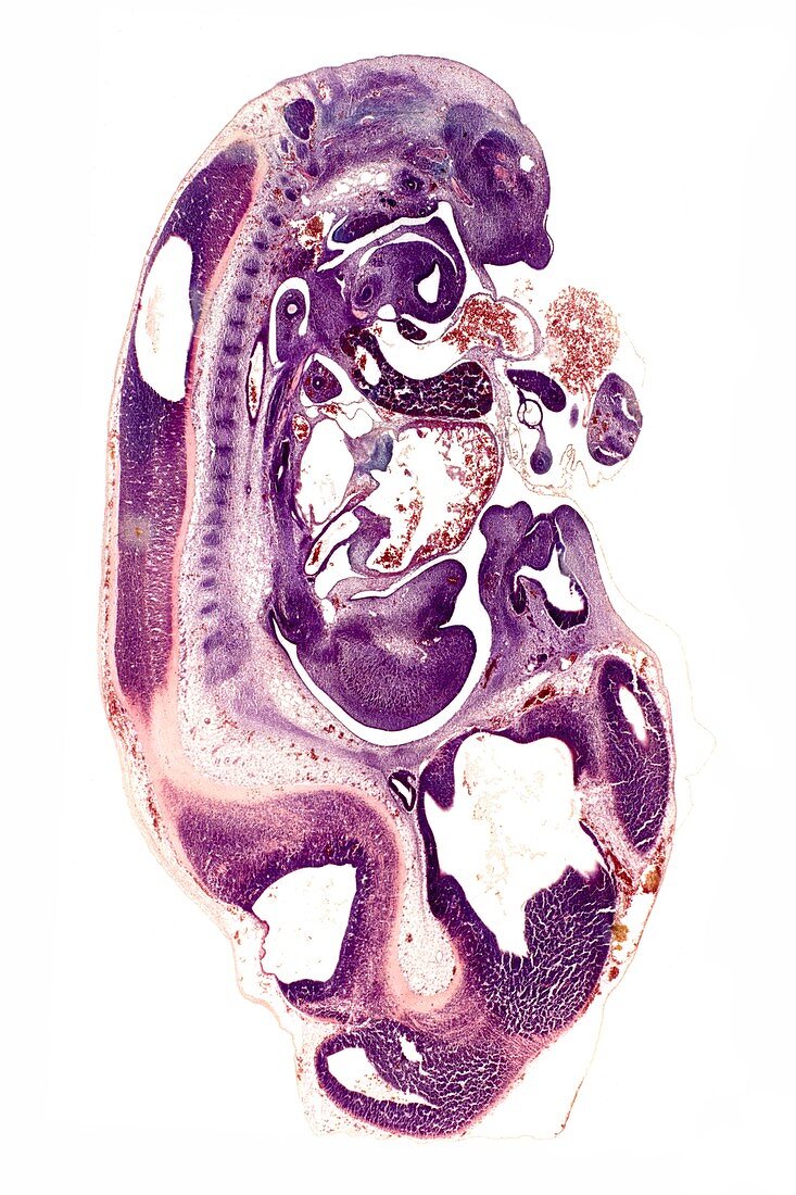 Woodmouse foetus,light micrograph