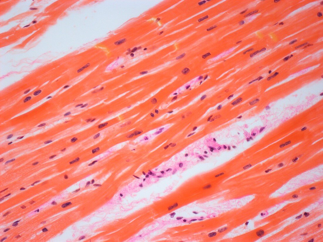 Human cardiac muscle,light micrograph
