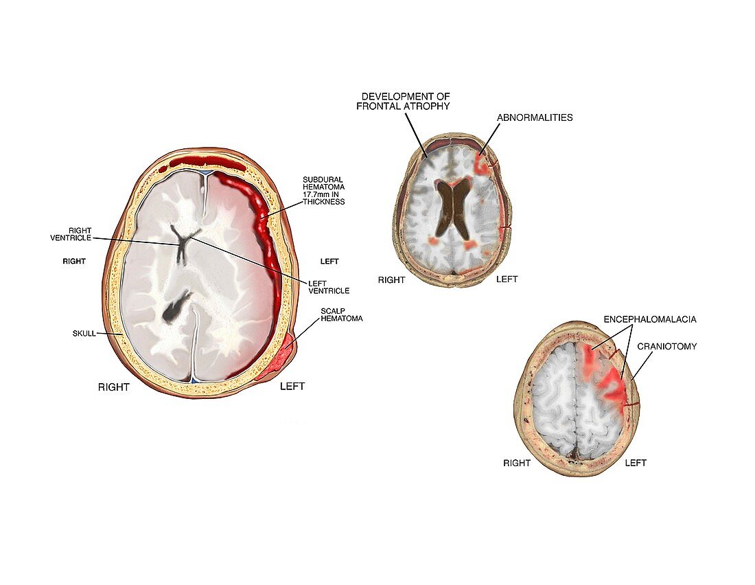 Brain injuries and abnormalities
