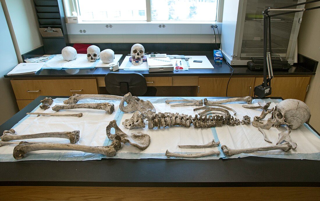 Human remains in a forensics laboratory