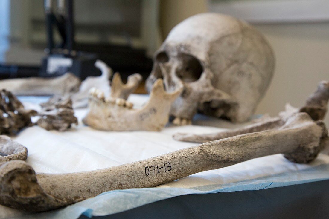 Human remains in a forensics laboratory