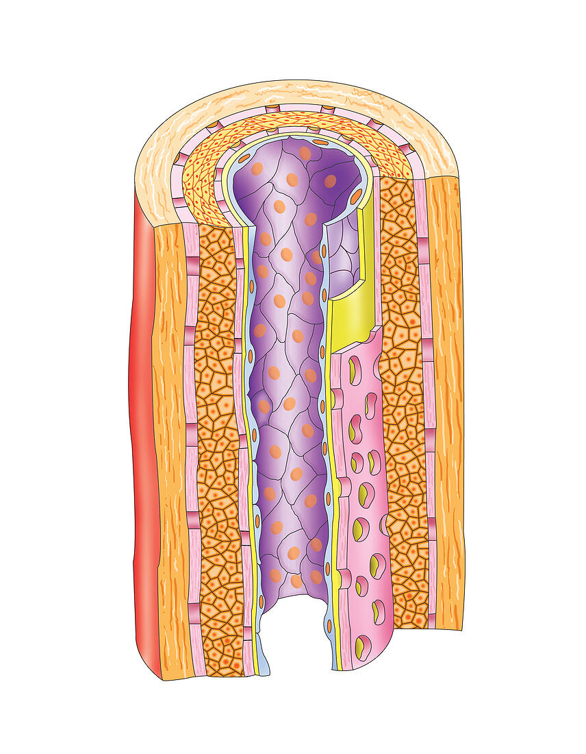 Vascular anastomosis,artwork